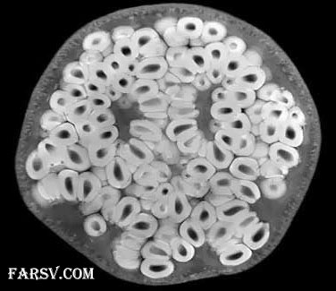 عکس MRI از انار عکس MRI از انار