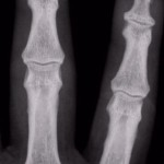 تبدیل موبایل به اشعه ایکس با اپلیکیشن X-Ray Scanner 1.7 (اندروید) دانلود نرم افزار X-Ray Scanner 1.7