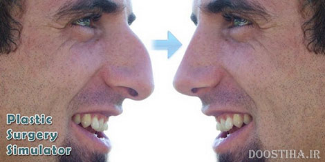 جراحی پلاستیک مجازی با اپلیکیشن Plastic Surgery Simulator v1.2.12 دانلود نرم افزار جراحی پلاستیک Plastic Surgery Simulator
