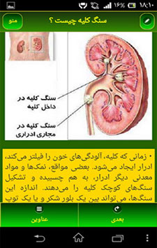 دانلود نرم افزار پیشگیری، تشخیص و درمان سنگ کلیه (اندروید) پیشگیری، تشخیص و درمان سنگ کلیه